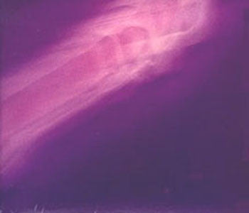 This Heat : Health & Efficiency / Repeat (LP, Album + 12", EP + Comp, RE, RM)